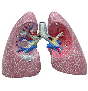 Model Lung